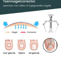 7-Delige Pedicure Set - Nagelverzorging - Nagelset Starterset - Ingegroeide Teennagel - Kalknagelproducten - Pedicuresets - RVS -Mode-Cosmetica Winkel 1200x1130 6