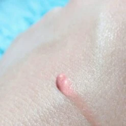 Lippenbalsem Natural Pink Biodermal Sun Lipbalm Lipbalsem SPF25 - Tube 12 Ml - 12 Lippenbalsem Natural Pink Biodermal Sun Lipbalm Lipbalsem SPF25 - Tube 12 Ml - -Mode-Cosmetica Winkel 1200x1200 448