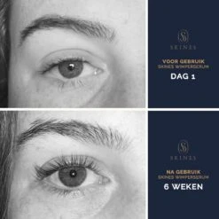 Skines® Wimperserum Premium – Eyelash Serum - Wenkbrauw Serum - Wimper Groei - 3ML -Mode-Cosmetica Winkel 1200x1200 590
