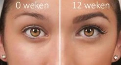 100% Natuurlijke Groei - Wenkbrauwserum - Vollere Wenkbrauwen - Castor Olie - Wenkbrauw Serum - 10ML -Mode-Cosmetica Winkel 1200x645