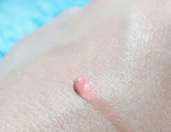 Biodermal Sun Lipbalm SPF25 - Tube 12 Ml - Natural Pink - Lippenbalsem -Mode-Cosmetica Winkel 1200x927 2